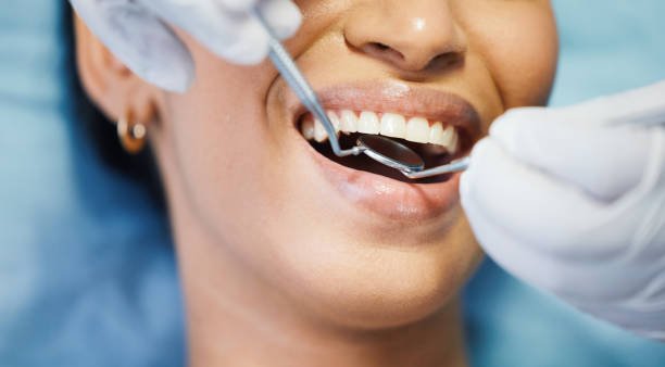 Best Emergency Dental Care for Broken or Chipped Teeth in Bellevue, IL