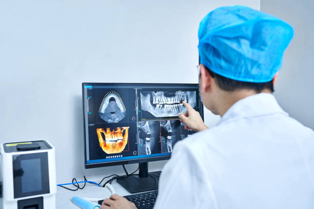 Best Emergency Wisdom Teeth Removal in Bellevue, IL